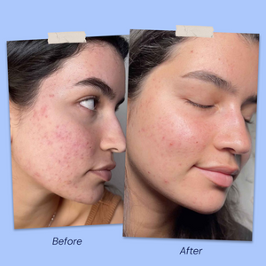 Before & After