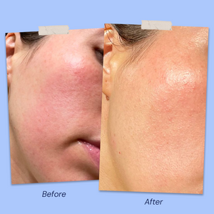 Before & After