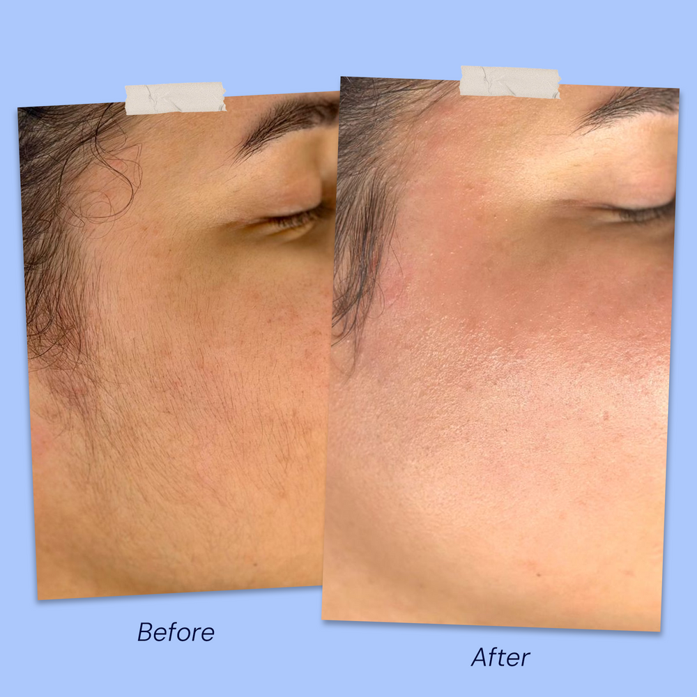 Before & After