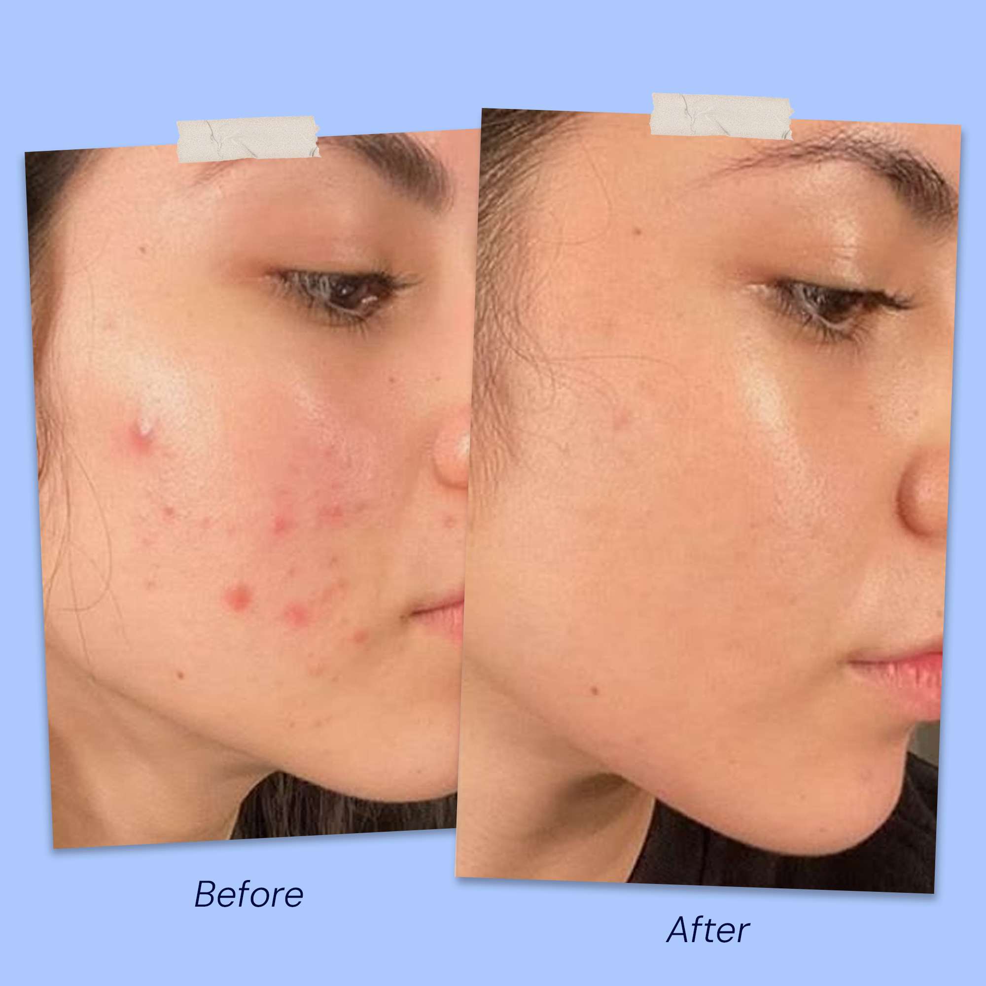 Before & After