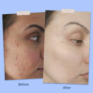 Before & After