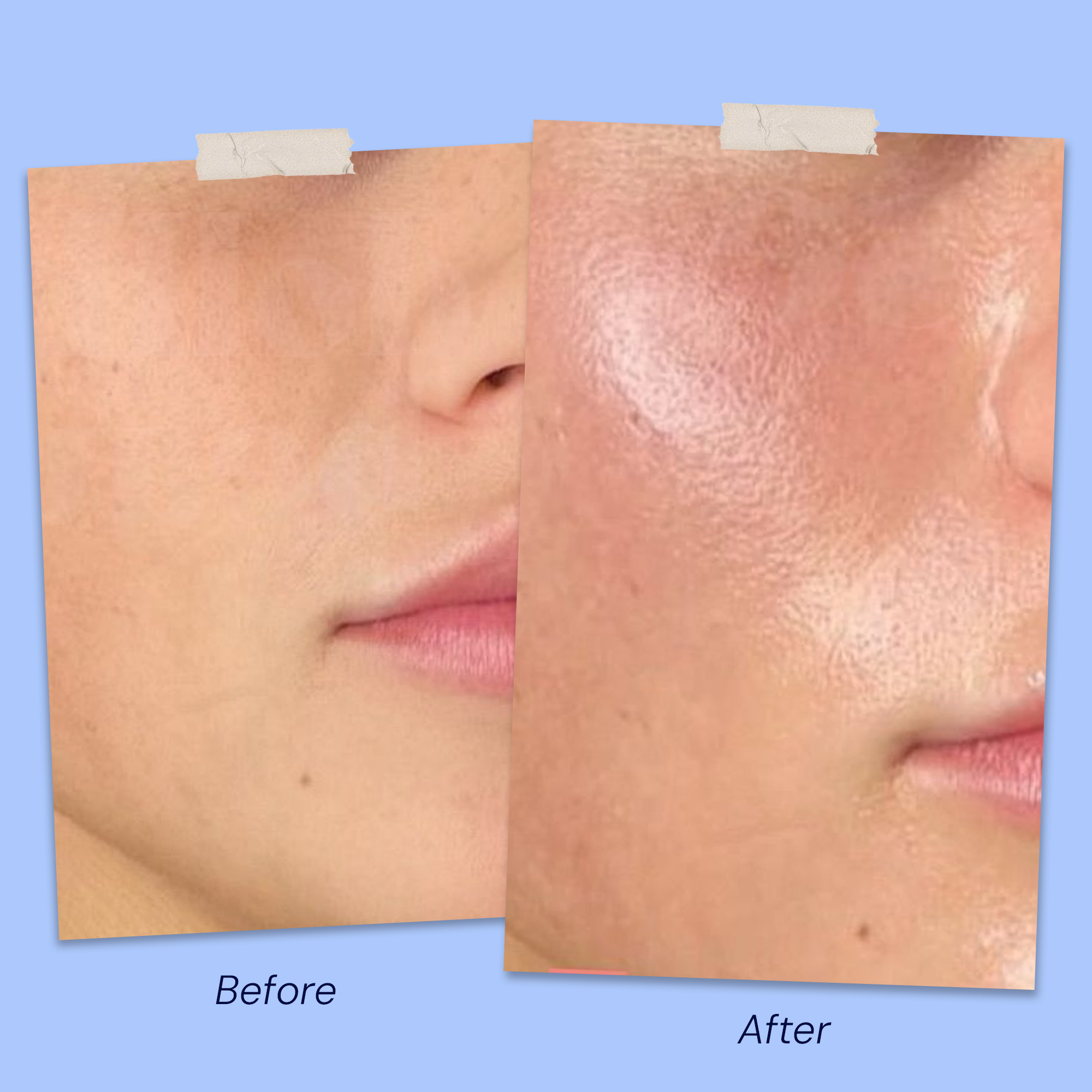 Before & After