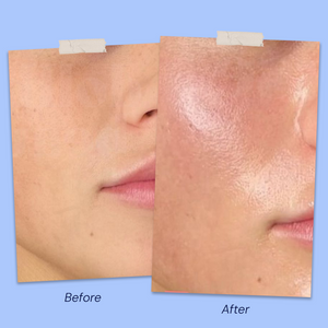 Before & After