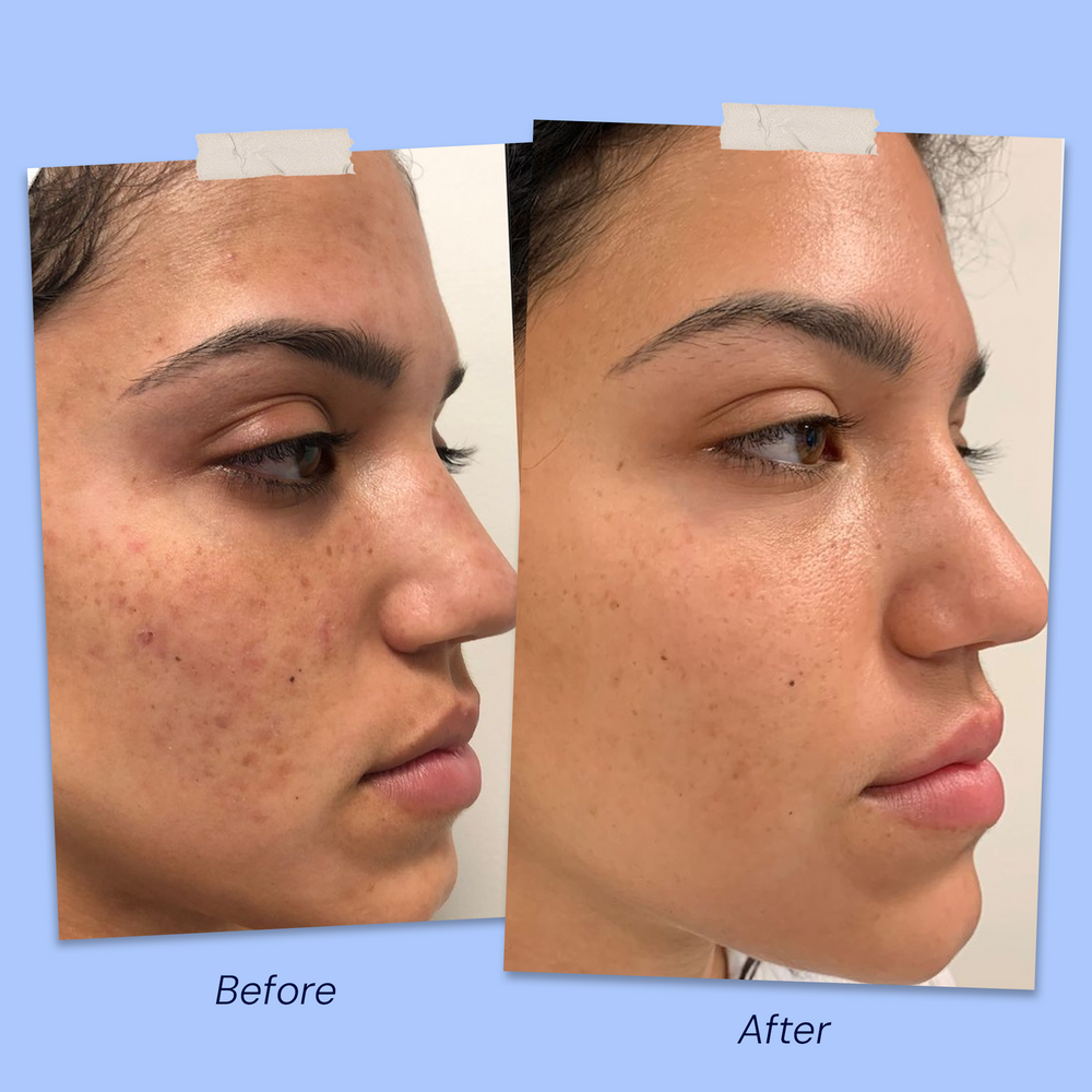 Before & After