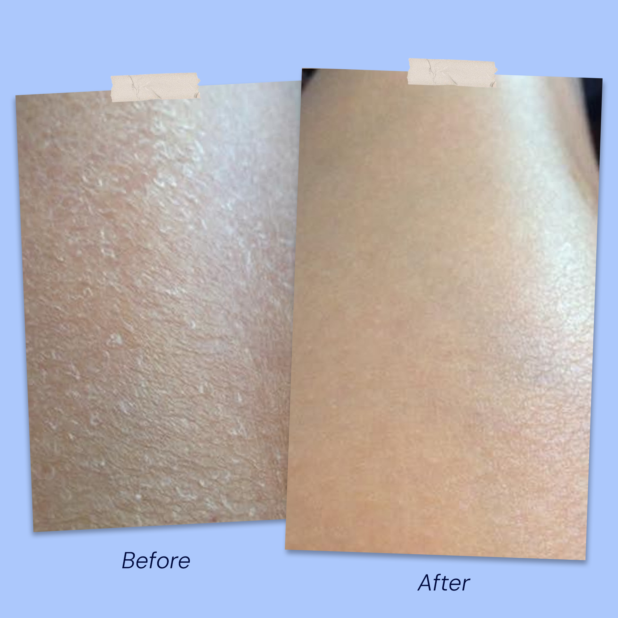 Before & After