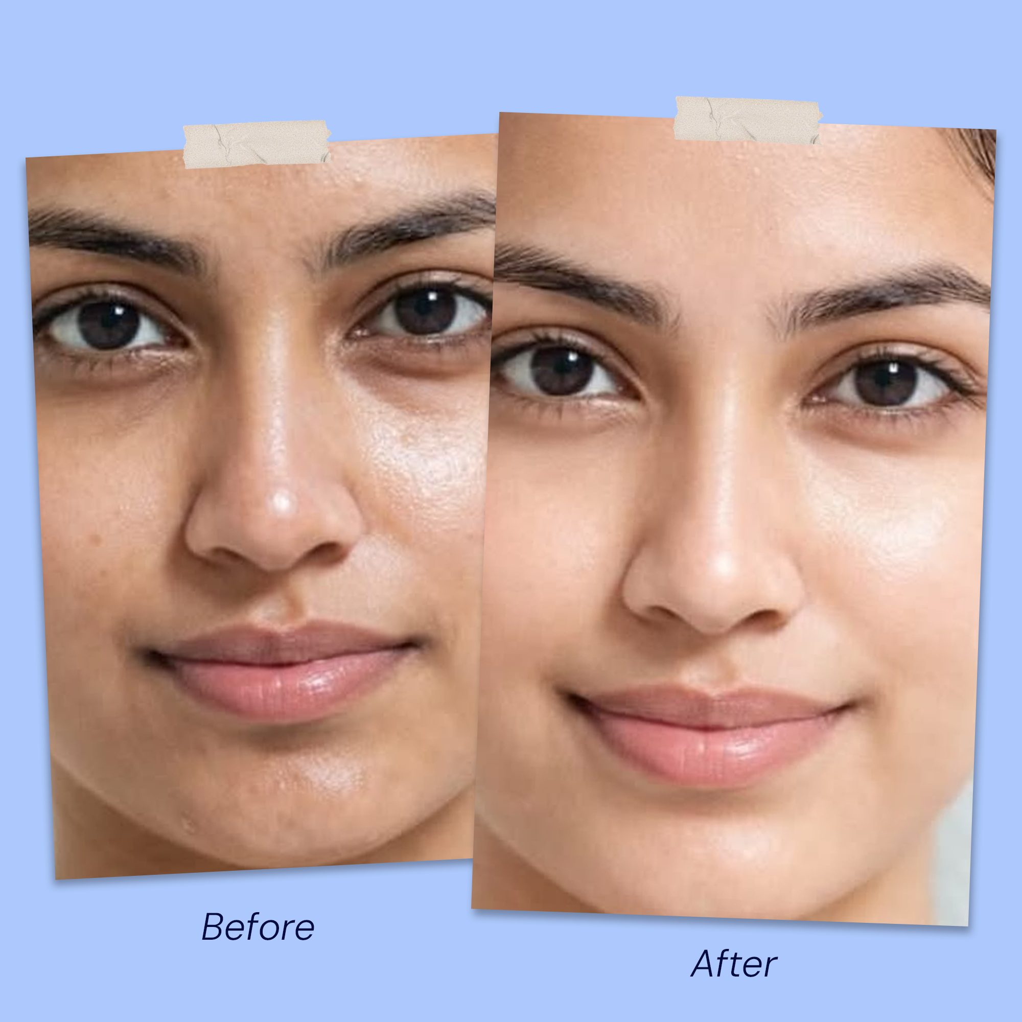 Before & After
